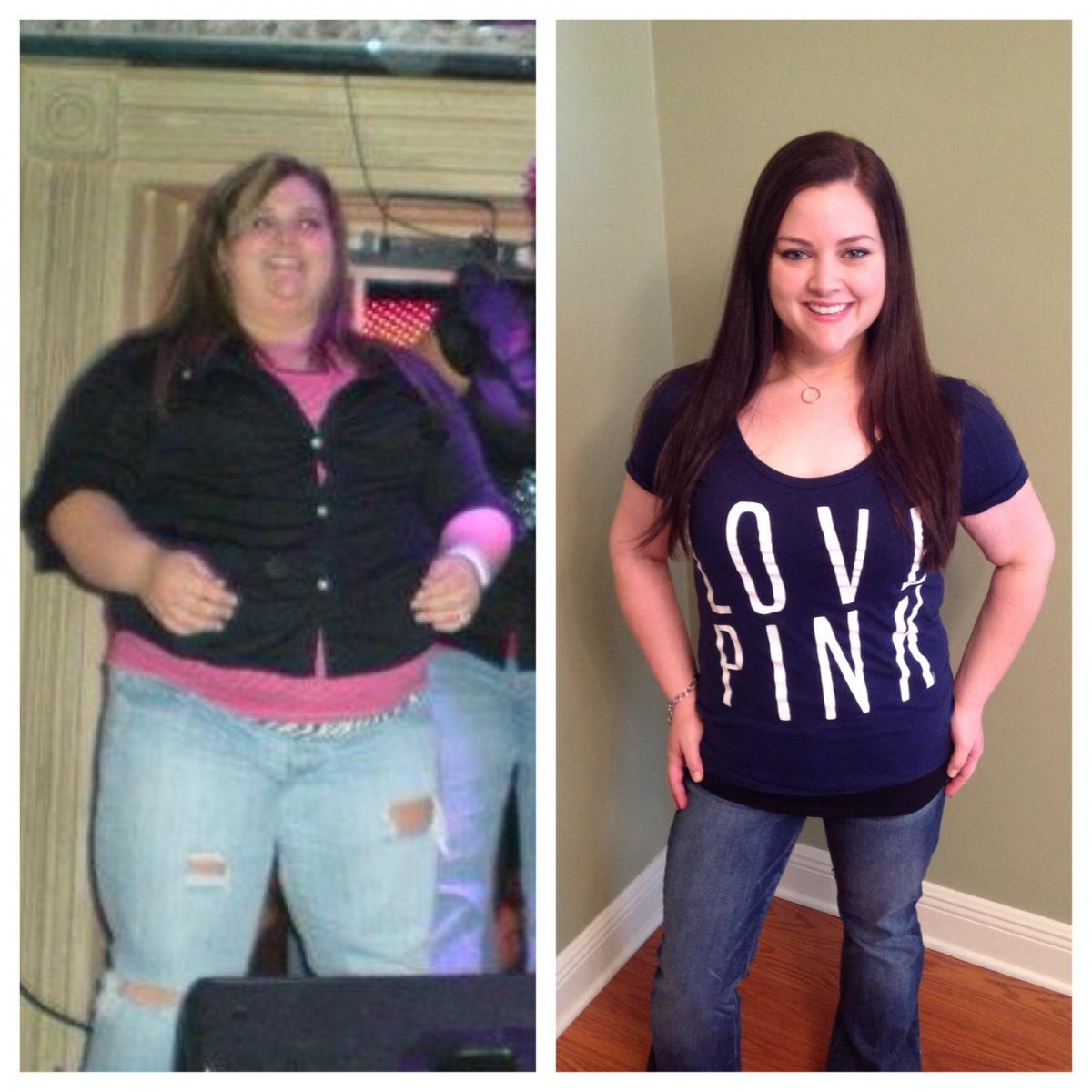 I Want To See Before &amp; After Pics! (Cont'd) - Gastric ...