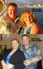 Ken and Lisa Pre Surgery-Post Surgery.jpg