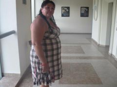 This is me August 2009.  Three months before my surgery
