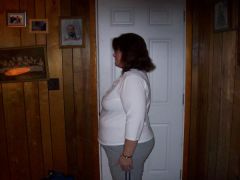 Night before pre-op diet pictures