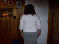 Back view of Mountain_lover before 2 week pre-op diet of protein shakes, protein bars and water.