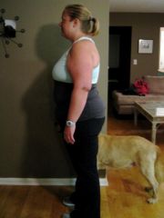 2 months post-op (-45lbs, 20 from pre-op diet)