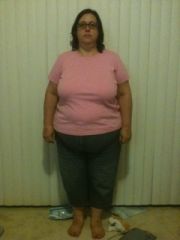 The Day before surgery... already 25 pounds down