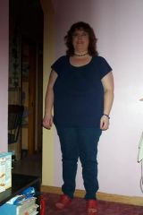 Before surgery - front view - 240 lbs.
