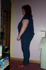 Before surgery - 240 lbs.