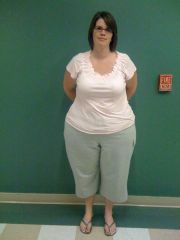 Pre-Surgery pics....I weigh 263 lbs. in this pic