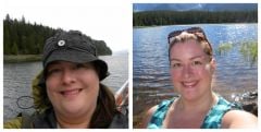 Face pic on my honeymoon in 2009; face pic at 3 months post op