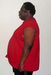 My profile picture just before I started the "Options" program in 7/2010
My weight was 318 Pounds.