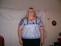 This is me at my heaviest the day before my surgery.