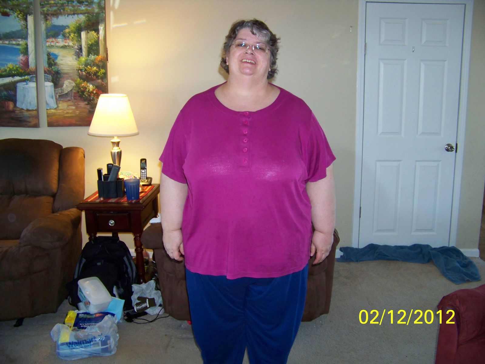 Before surgery - 331 lbs