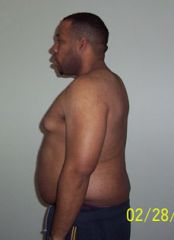 Before (Feb. 2005): I started out at 315lb.