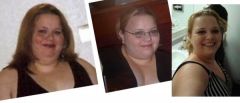Me at my heaviest then, Right before operation after the diet. Last picture on the right is me after losing 84lbs.