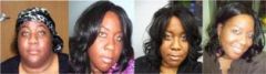 Before and After Face Shots  Surgery Date 2-16-11  SW 446   CW 292   GW 190