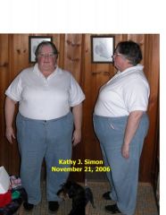Kathy 11-21-06, at almost 300#. I will have to post a pre-op photo once surgery is scheduled, as I've gained 40 some pounds.