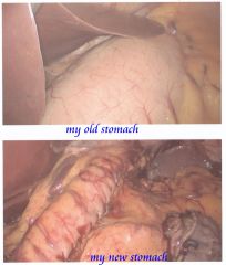 my stomach changes