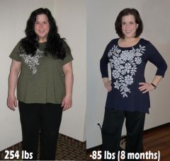 Weight Loss Progress 2012 surgery4.jpg