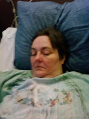 12/23/08 Day of Surgery.