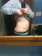 My Belly After (Showing loose skin)