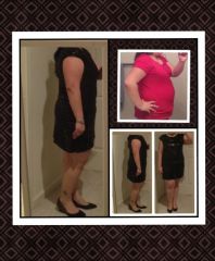 Little black dress at 6 weeks post-op