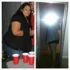 Before surgery (Left) .....and 4 mnths later