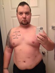 1 week post Opp (230lbs)