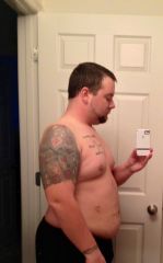 1 week post Opp side (230lbs)