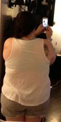 2 Weeks After Surgery, Back. Weight: 277 pounds