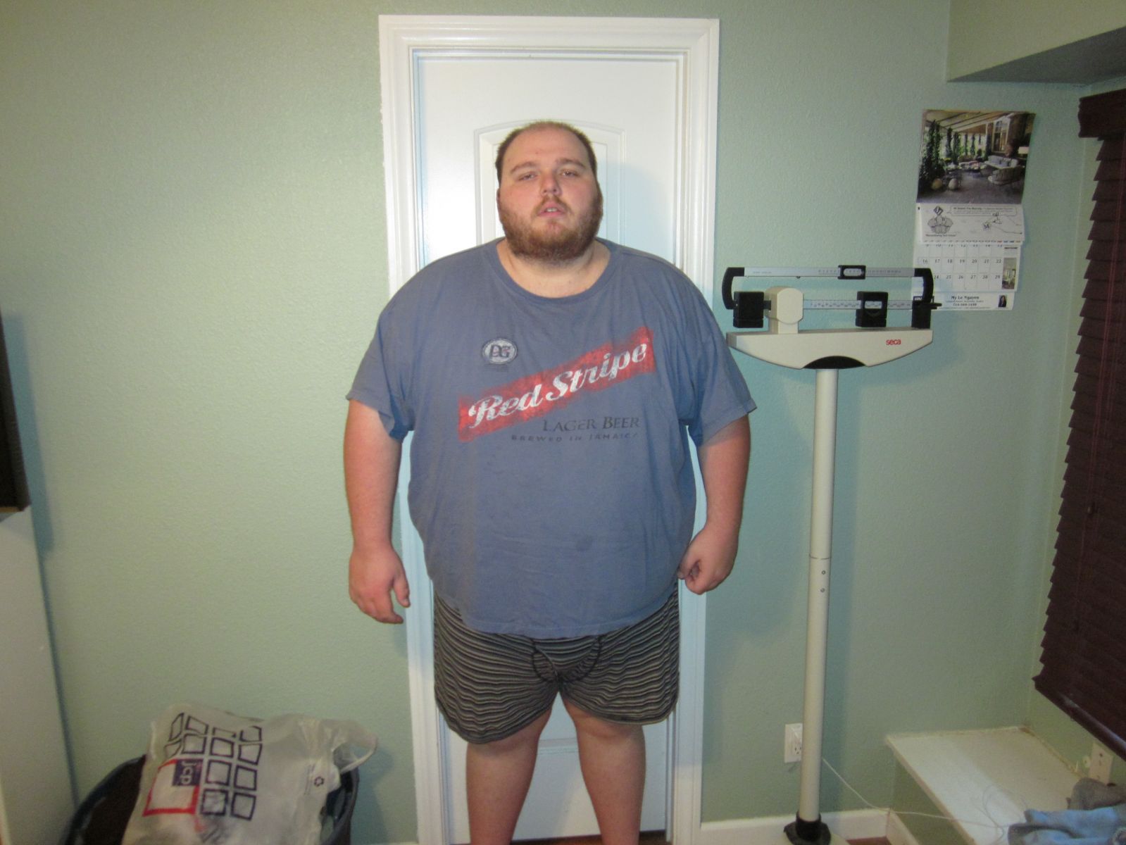 Picture 001.jpg - Before and After Gastric Sleeve Photos - BariatricPal