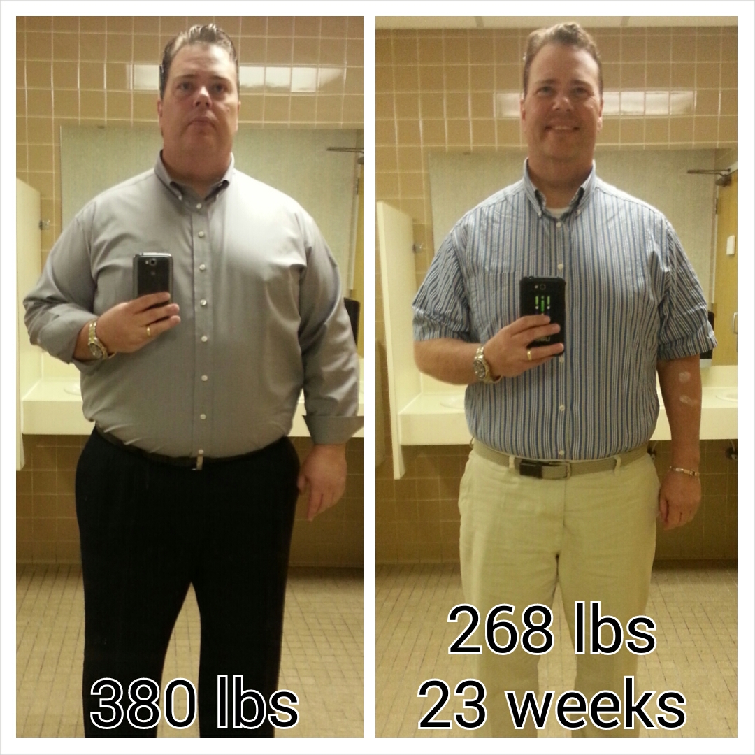 24.  VSG 24 weeks, 268 lbs