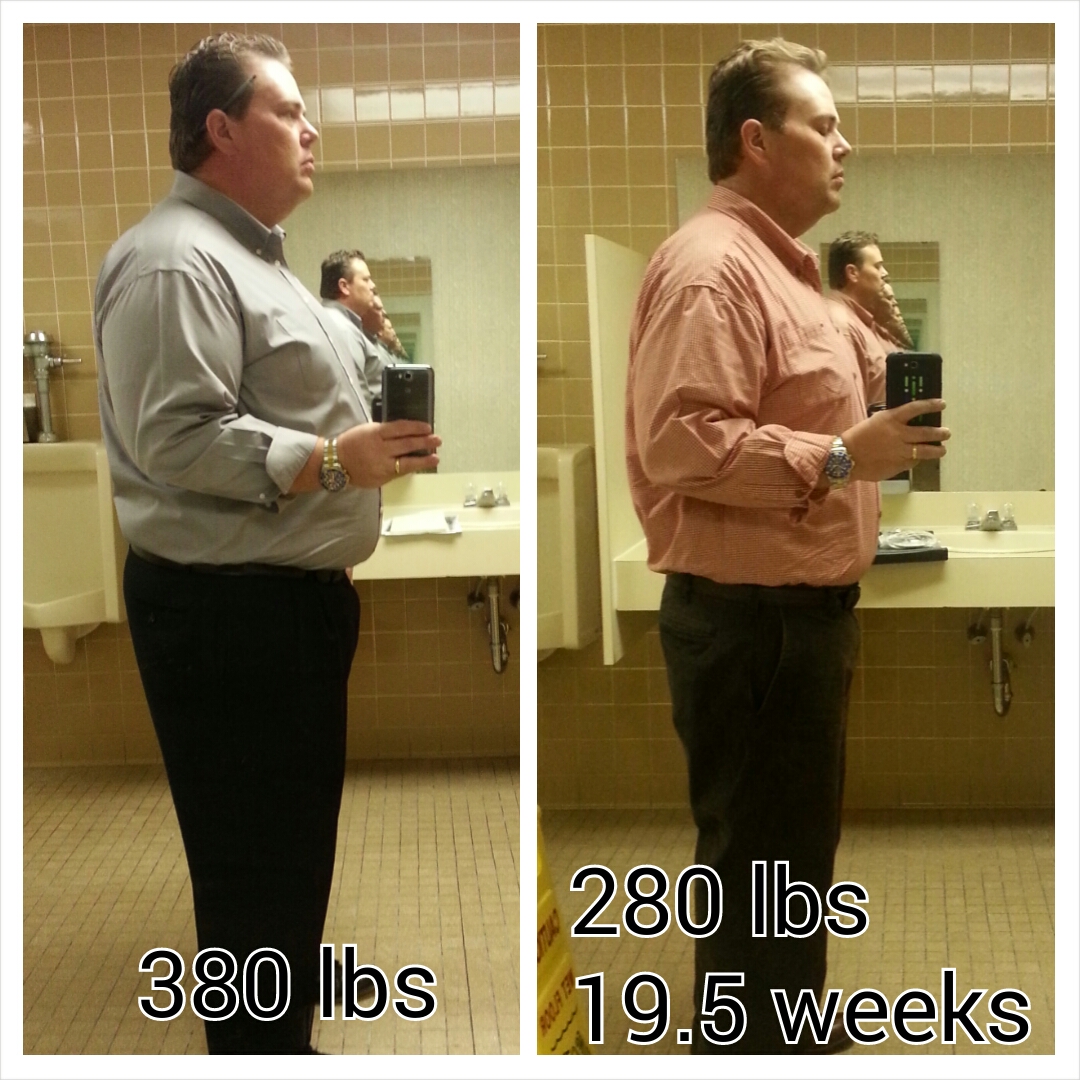 16.  VSG 19.5 weeks, 280 lbs