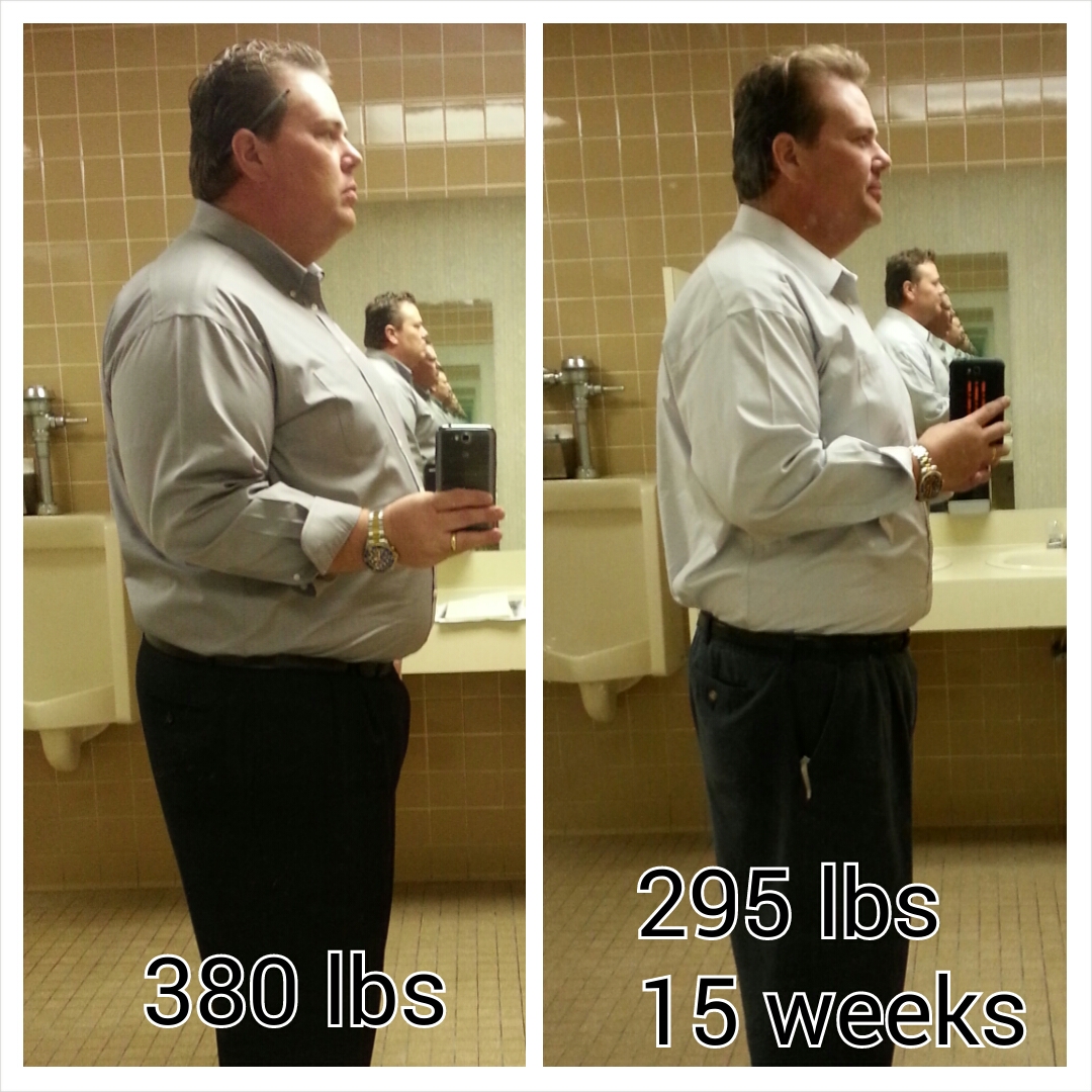 14.  VSG 15 weeks, 295 lbs