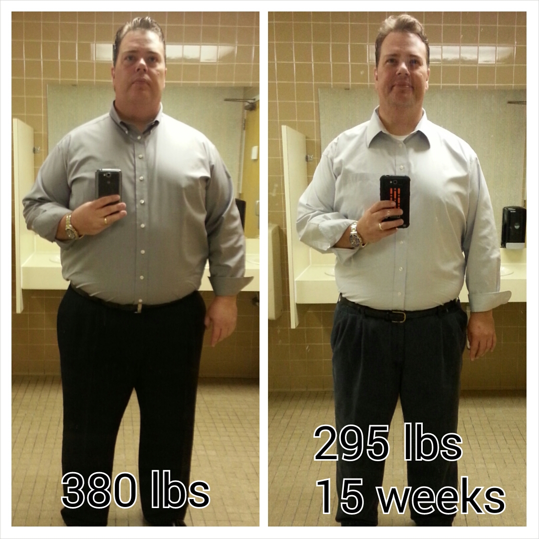 13.  VSG 15 weeks, 295 lbs