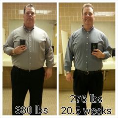 19.  VSG 20.5 weeks, 276 lbs