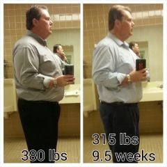 10.  VSG 9.5 weeks, 315 lbs