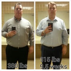 9.  VSG 9.5 weeks, 315 lbs