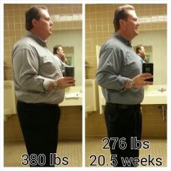 20.  VSG 20.5 weeks, 276 lbs
