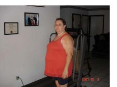 Me 17 days before surgery. 234 pounds