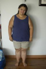 Post-op 8/7/12 (3 months out)