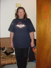 night before surgery-down 55 pounds! LA Weightloss and exercise