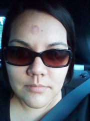 Hickey on Forehead Easter 2012