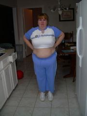 the day of my surgery at 242 lbs