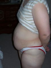 Picture me before tummy tuck and theigh lipo june 24th 2009 002. I now weigh 145 after 11 mths of weight loss on weight watchers