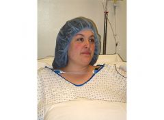 My face at it's largest ever.  Day of surgery.  298 pounds.  January 4, 2008