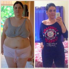 Before and 10 months post op , 97 lb lost (45 kg)