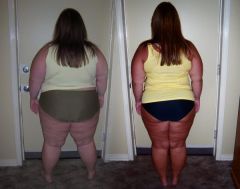 81 pounds down in this pictures.  banded 1/27/2009