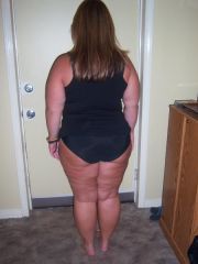 Oooh, the dreaded cellulite shot!