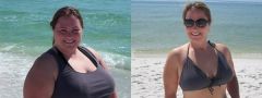 3-8-2010 About 128 pounds down here. the picture on the left is not my highest.  It was taken about two weeks after surgery last yeary.