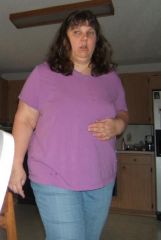 June 2008, 10 days after surgery, ooh, I'm still so sore! But my clothes are already starting to be loose!
