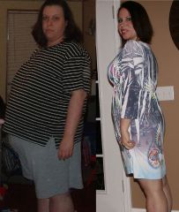 Side view of me. On the left I am at my highest weight ~300 pounds.  On the right is me currently at 1 year postop LapBand.  I have lost 107 pounds and weight 188!  Yay!
