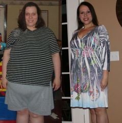 Side view of me. On the left I am at my highest weight ~300 pounds.  On the right is me currently at 1 year postop LapBand.  I have lost 107 pounds and weight 188!  I want to lose about another 28-33 pounds.